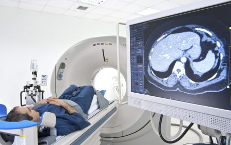 剤 ct 造影 [腹部造影CT検査を受ける事になった時、知っておくことはこれだけ」