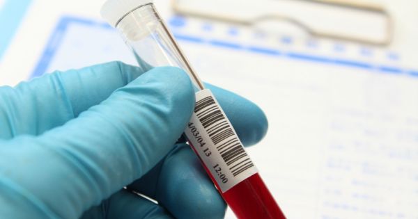 ALP(アルカリホスファターゼ):肝臓や骨、小腸、胎盤の損傷で異常値を示す